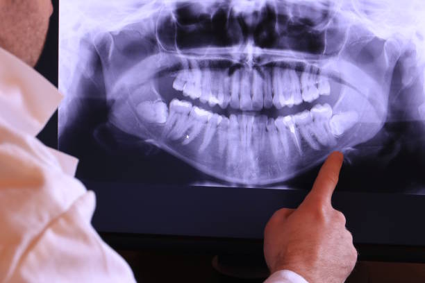 Best Emergency Gum Treatment in Mount Pleasant, UT