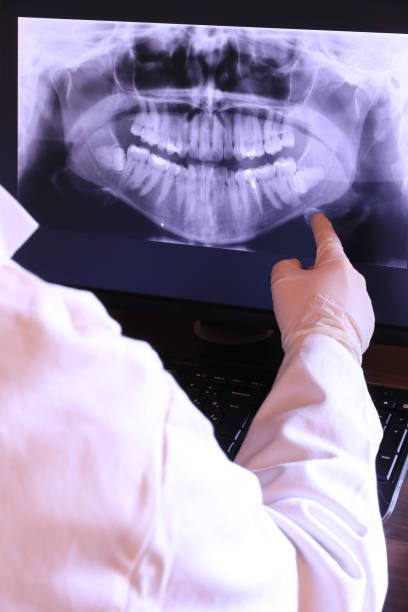 Best Emergency Root Canal Treatment in Mount Pleasant, UT