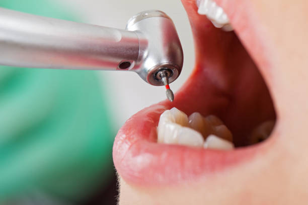 Best Weekend Emergency Dentist in Mount Pleasant, UT